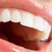 implante dental berrini